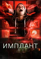  Имплант смотреть онлайн (2021) 